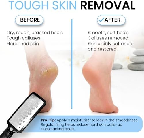 Rikans Colossal Foot File Foot Rasp Callus Remover for Soft Smooth Feet
